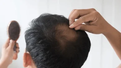 موی رفته دیگه هیچ وقت نمیاد؟