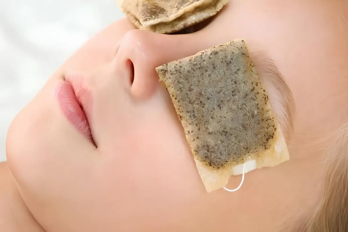 درمان سریع ورم چشم با روش های خانگی 5 کمپرس چای کیسهای