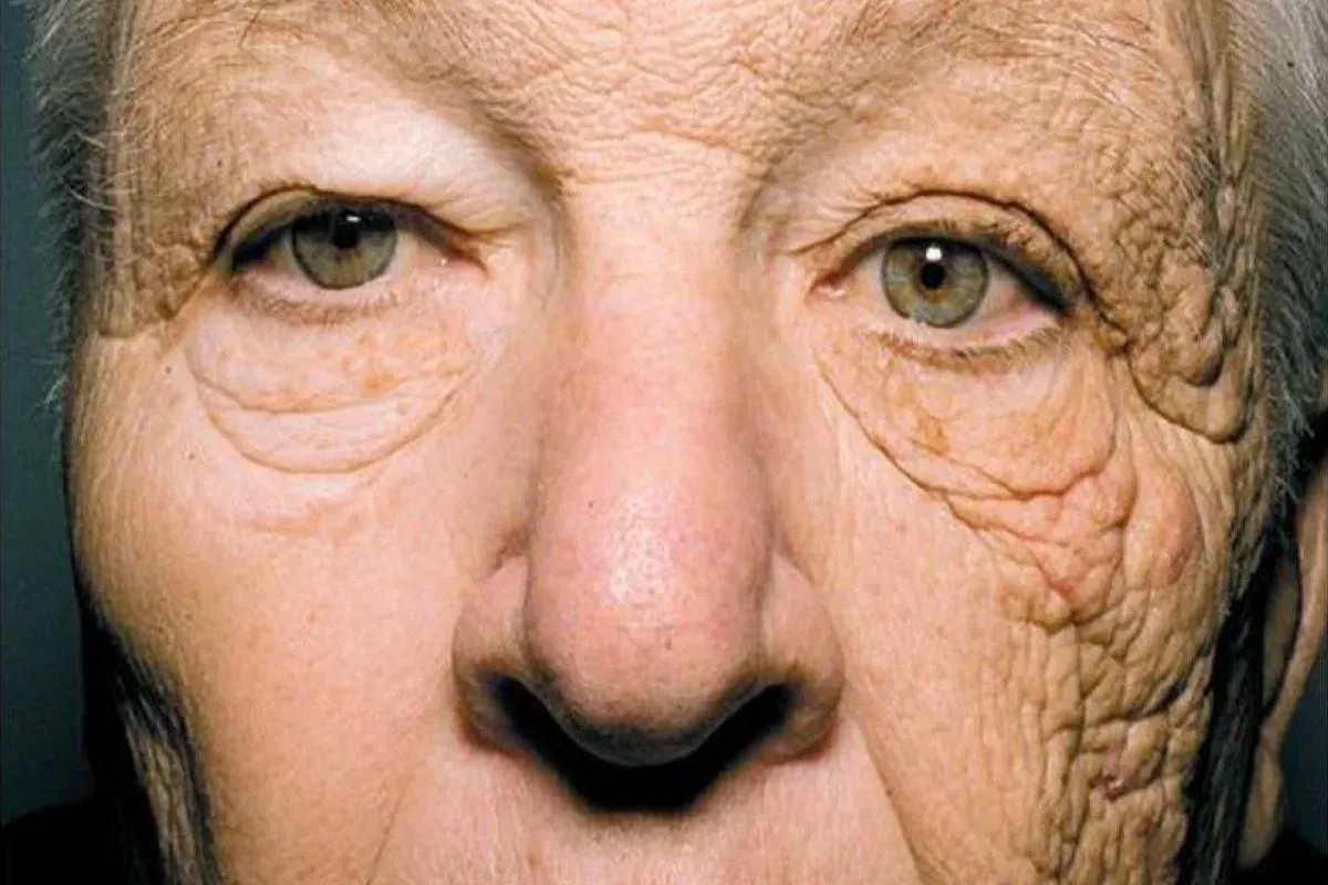 اهمیت ضدآفتاب: فواید، عوارض و انتخاب بهترین نوع 5 راز جوانی ابدی: جلوگیری موثر از پیری زودرس پوست